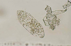 Phytoplankton showing chlorophyl. Phytoplankton showing chlorophyl.