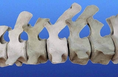 Sperm Whale (Physeter macrocephalus)